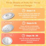 Velpeau Umbilical Hernia Belt Baby Belly Band, Button Wrap Truss Abdominal Binder for Infant, Children, Kids, Adjustable Support Belt with 3 Compression Pads, Beige, One Size - Image 4